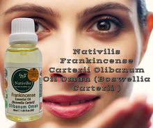 Load image into Gallery viewer, Nativilis Frankincense Carterii Olibanum Oil Oman (Boswellia Carterii ) - natural anti-acne anti-wrinkle improve oral hygiene prevent gum disease antibacterial properties - Copaiba properties 30ml Media 1 of 36
