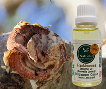 Load image into Gallery viewer, Nativilis Frankincense Carterii Olibanum Oil Oman (Boswellia Carterii ) - natural anti-acne anti-wrinkle improve oral hygiene prevent gum disease antibacterial properties - Copaiba properties 30ml Media 1 of 36
